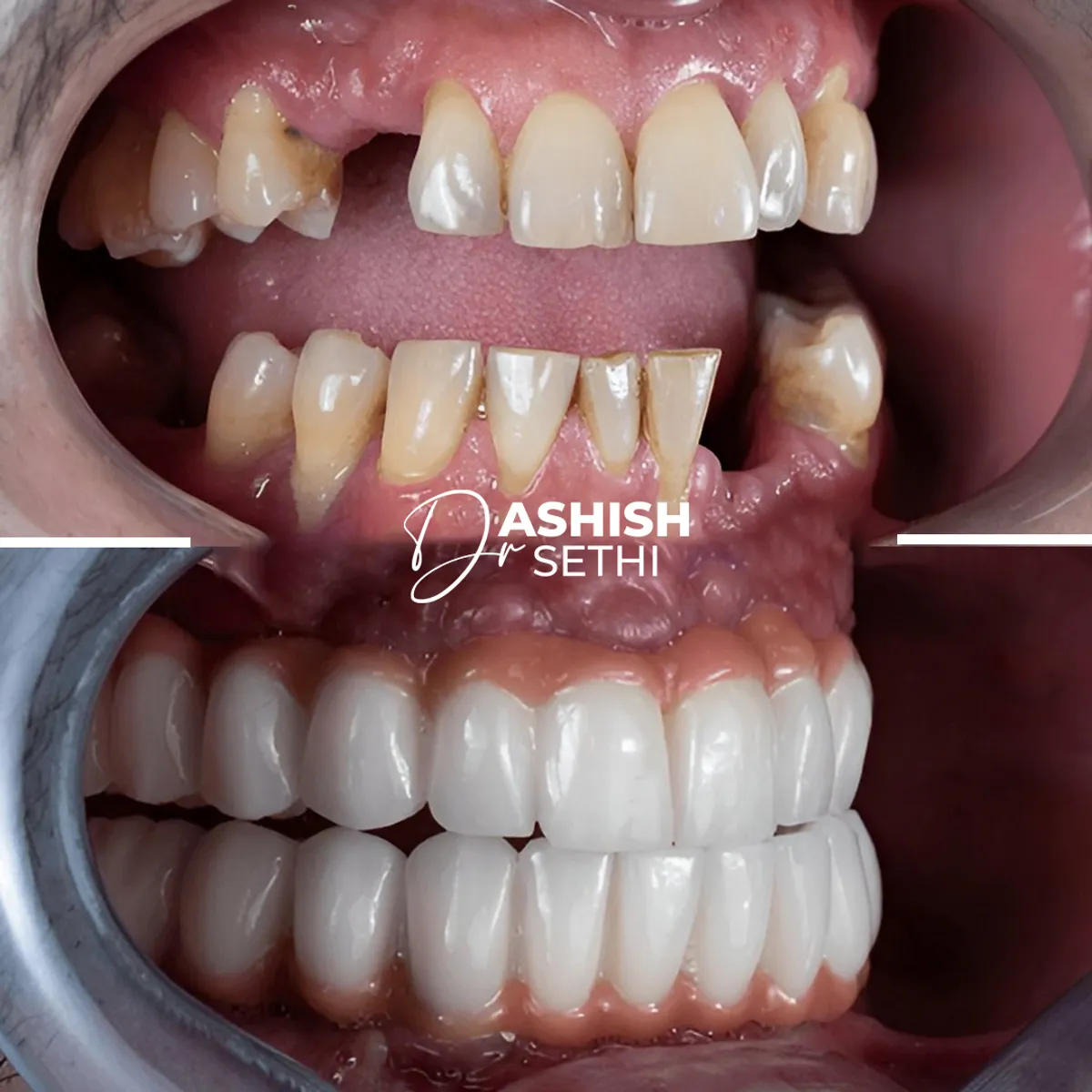 Before and After Transformation 6